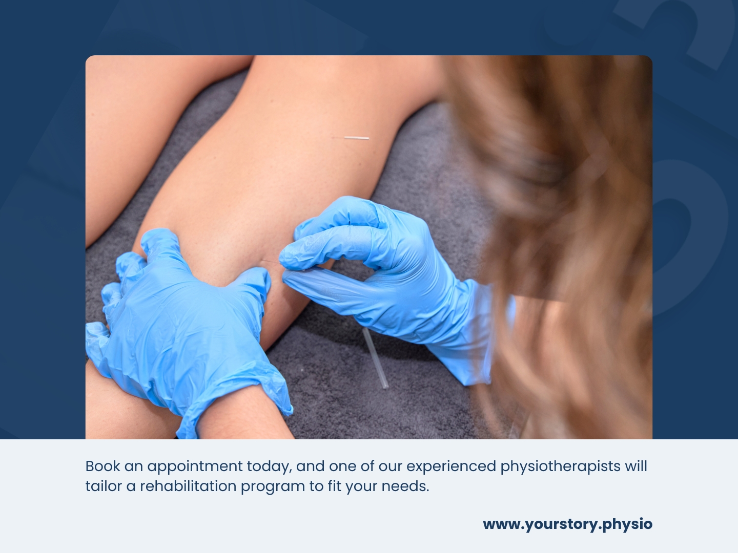 Dry Needling Physiotherapy Melbourne | Your Story Physiotherapy